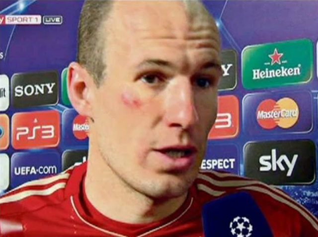 A német Bild bulvárlap szerint Ribéry és Robben összeverekedett a Real Madrid elleni keddi BL-elődöntő szünetében.