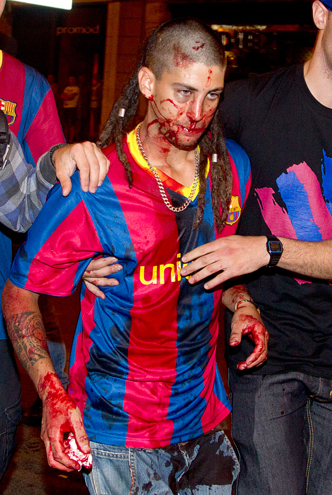 Egy Barcelona-szurkolót vezetnek Barcelona utcáján, aki megsérült a rendőrséggel való összecsapásokban, amelyek azután alakultak ki, hogy a Barcelona megnyerte a Manchester United elleni BL-döntőt 2011 májusában